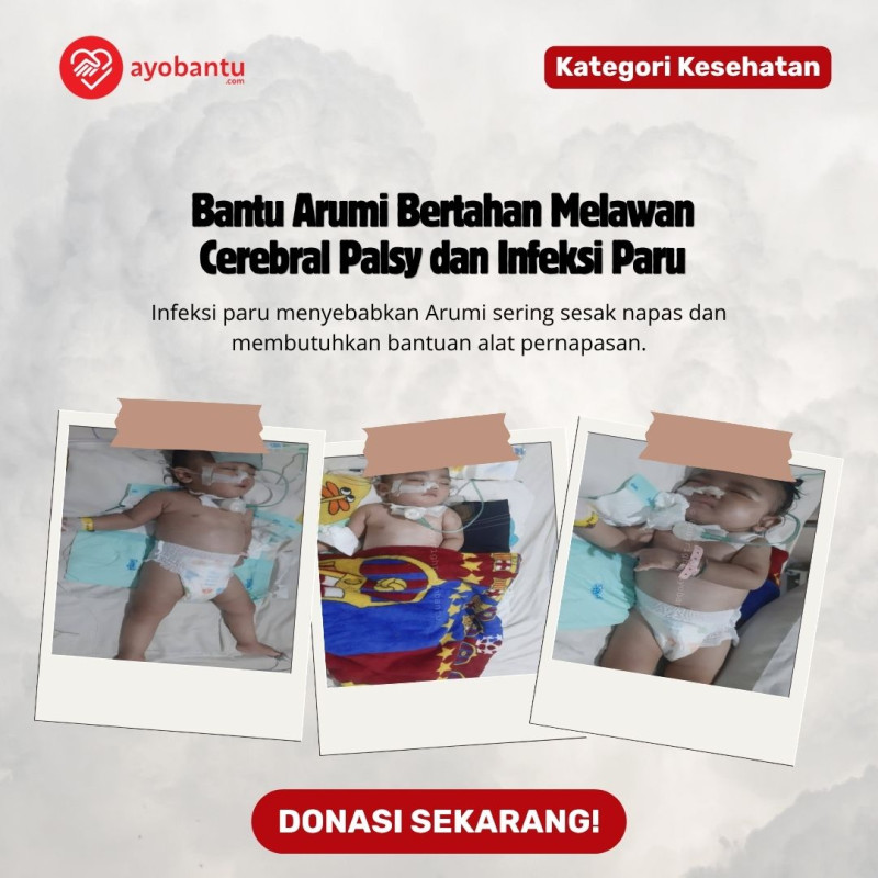 Temani Arumi Berjuang Lawan Sakit Komplikasi