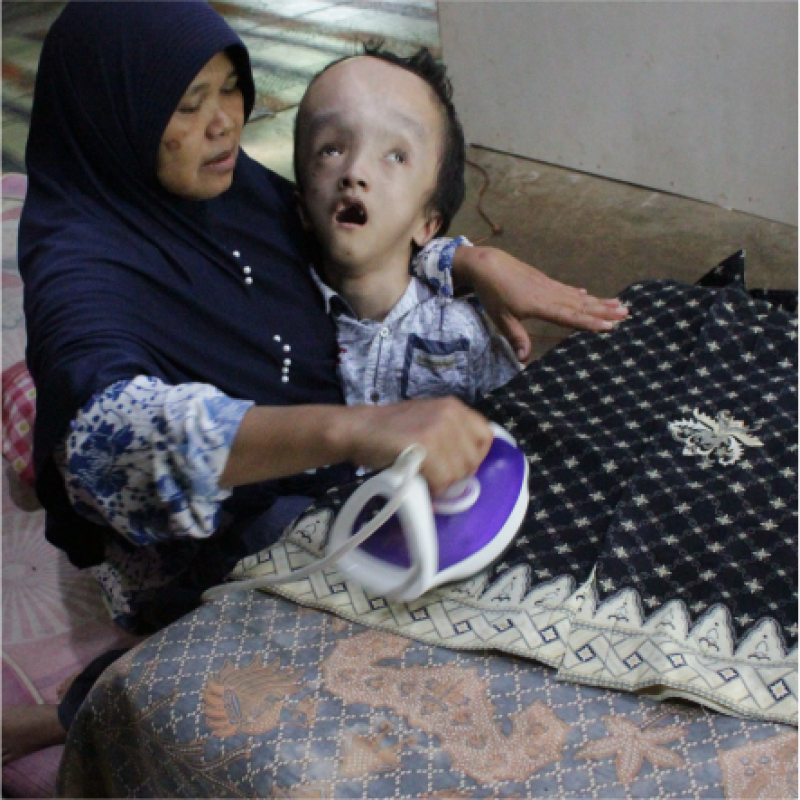 Bantu Modal Usaha dan Biaya Kontrol Kesehatan Penderita Hidrosefalus