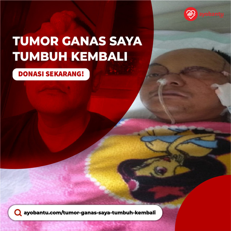 TUMOR GANAS SAYA TUMBUH KEMBALI