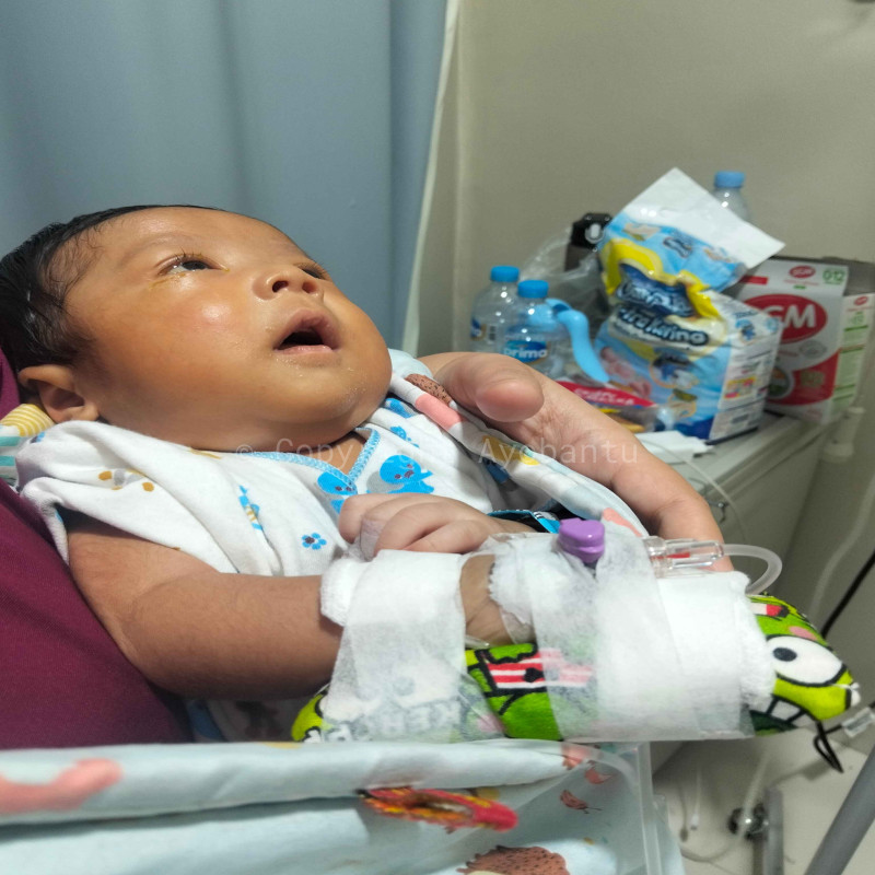 Bantu bayi ALFI sembuh dari penyakit-penyakit jantung langka TRUNCUS ARTERIOSUS