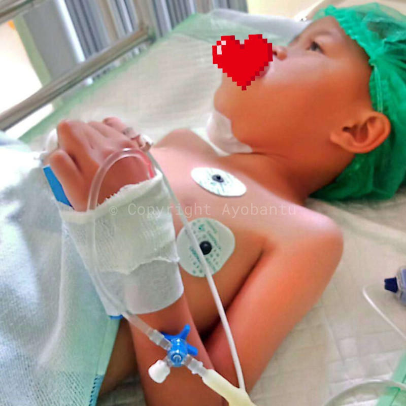 Bantu Febio (5 th) Melawan Tumor Lidah — Biaya Perawatan & Transportasi