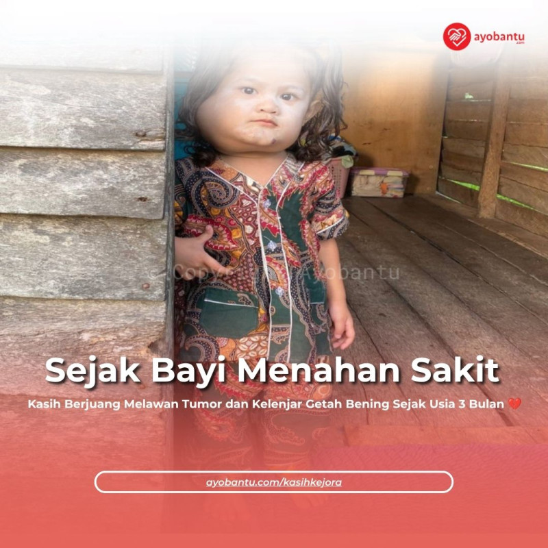 Bantu Kasih Bisa Menjalani Perobatan Medis