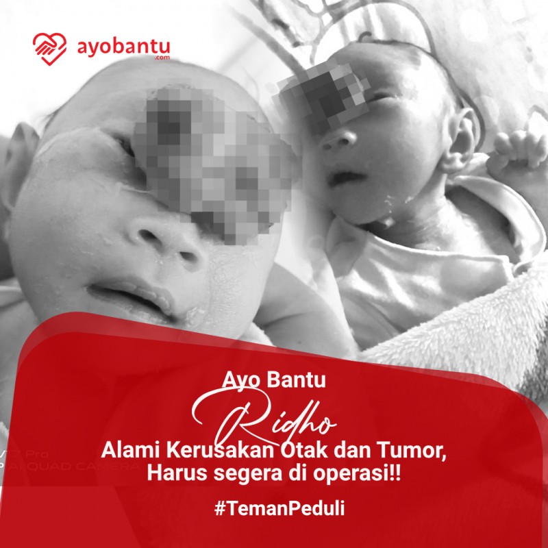 Ayo Bantu De Ridho Alami Kerusakan Otak dan Tumor, Harus segera di operasi!!