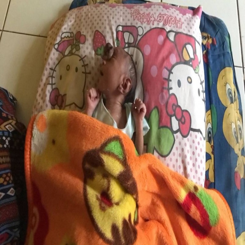 Ayo Bantu De Ridho Alami Kerusakan Otak dan Tumor, Harus segera di operasi!!