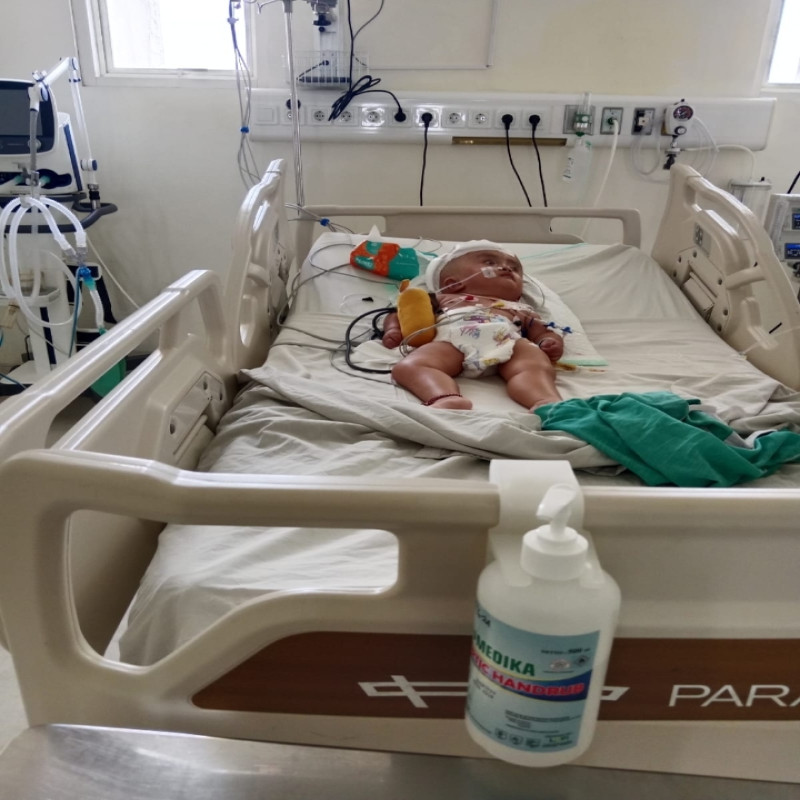 Hidrosefalus Epilepsi dan Spinabifida 3 Penyakit Sekaligus Menyerang Fariz!!