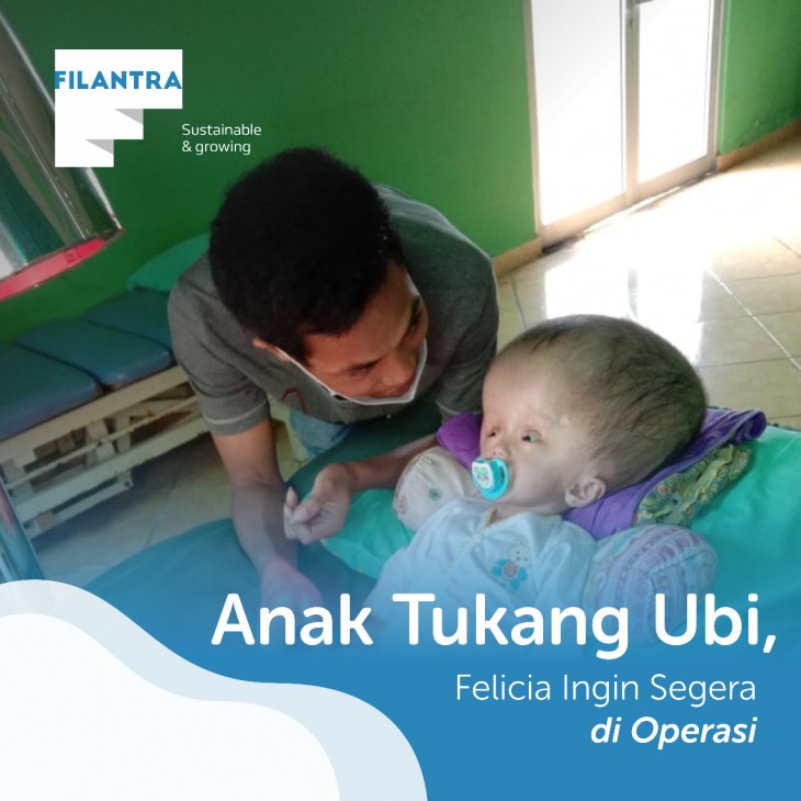 Kepala Felicia Kian Membesar Melebihi Ukuran Tubuh
