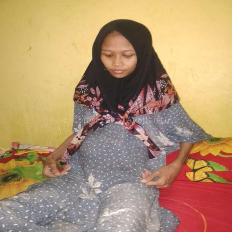 Ulurkan Tanganmu, Bantu Ibu Rikah Sembuh dari Derita Asites