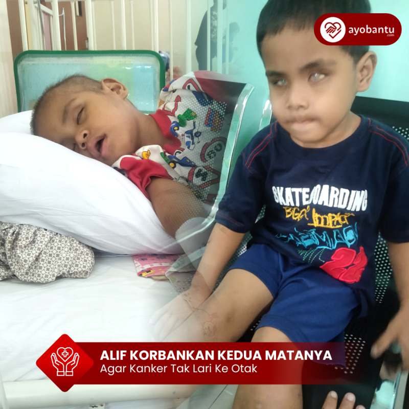 Agar Kanker Tak Lari Ke Otak, Alif Korbankan Mata