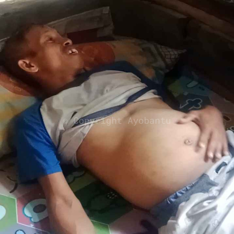 bantu ajon melawan penyakit tumor
