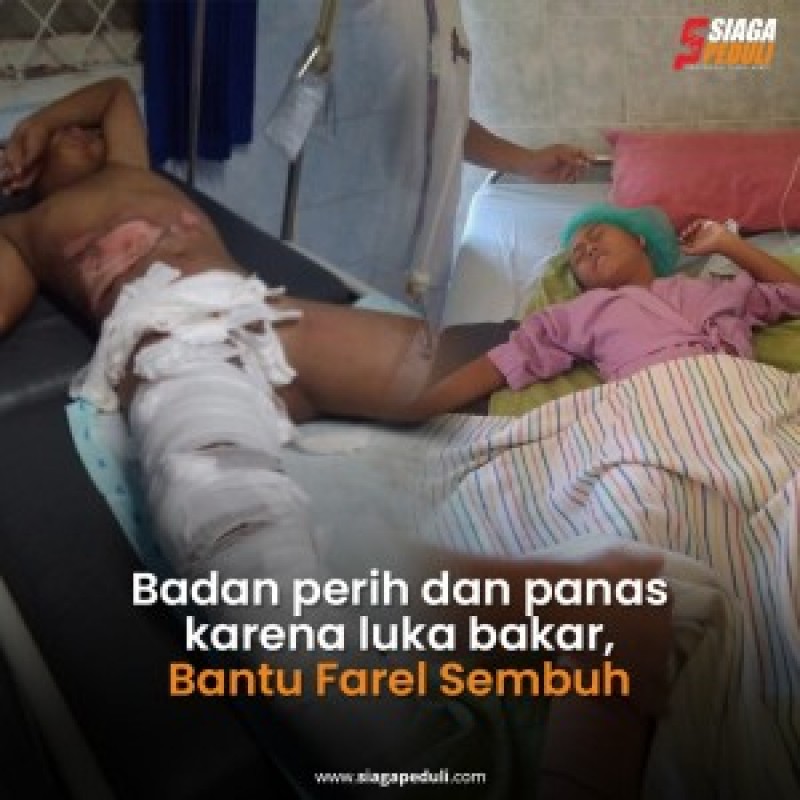 Badan Perih dan Panas Karena Luka Bakar Bantu Farel Sembuh