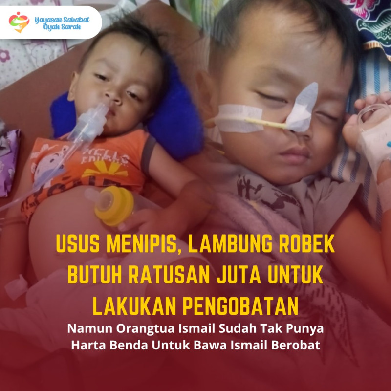 Usus Menipis &amp; Lambung Robek Bantu Ismail Sembuh