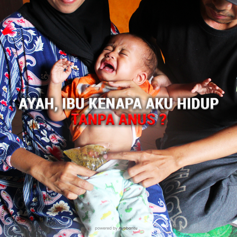 Ardiansyah, Bayi Satu Tahun Anak Buruh Jahit Kulit Harus Hidup Tanpa Anus