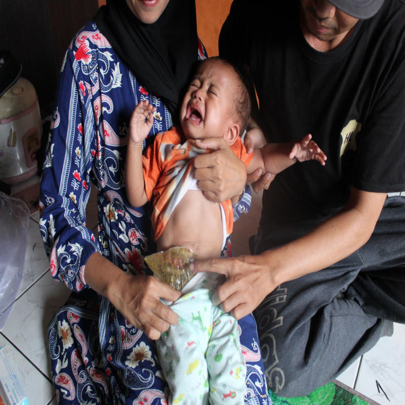 Ardiansyah, Bayi Satu Tahun Anak Buruh Jahit Kulit Harus Hidup Tanpa Anus