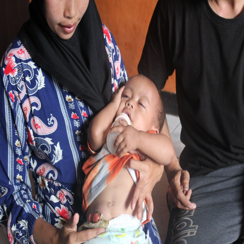 Ardiansyah, Bayi Satu Tahun Anak Buruh Jahit Kulit Harus Hidup Tanpa Anus