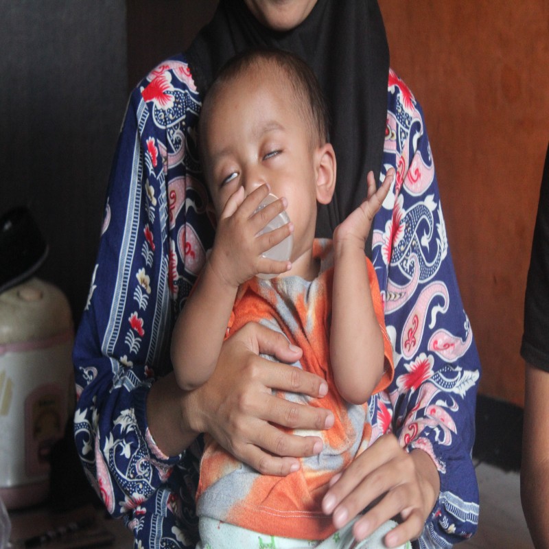 Ardiansyah, Bayi Satu Tahun Anak Buruh Jahit Kulit Harus Hidup Tanpa Anus