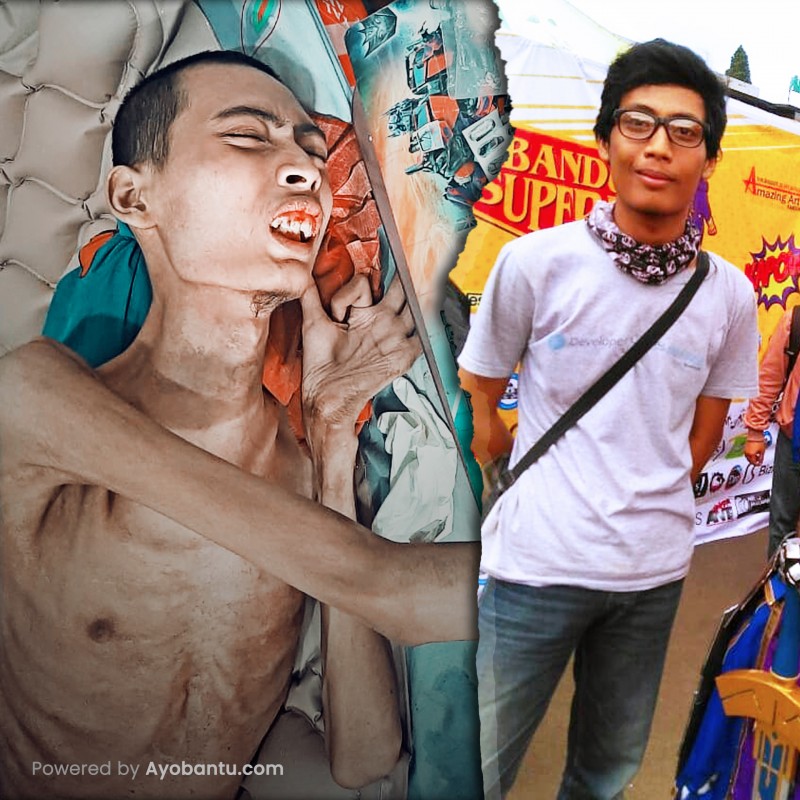 Badan Semakin Kurus, Dang Ridho Berjuang Lawan TBC Tulang & Diabetes