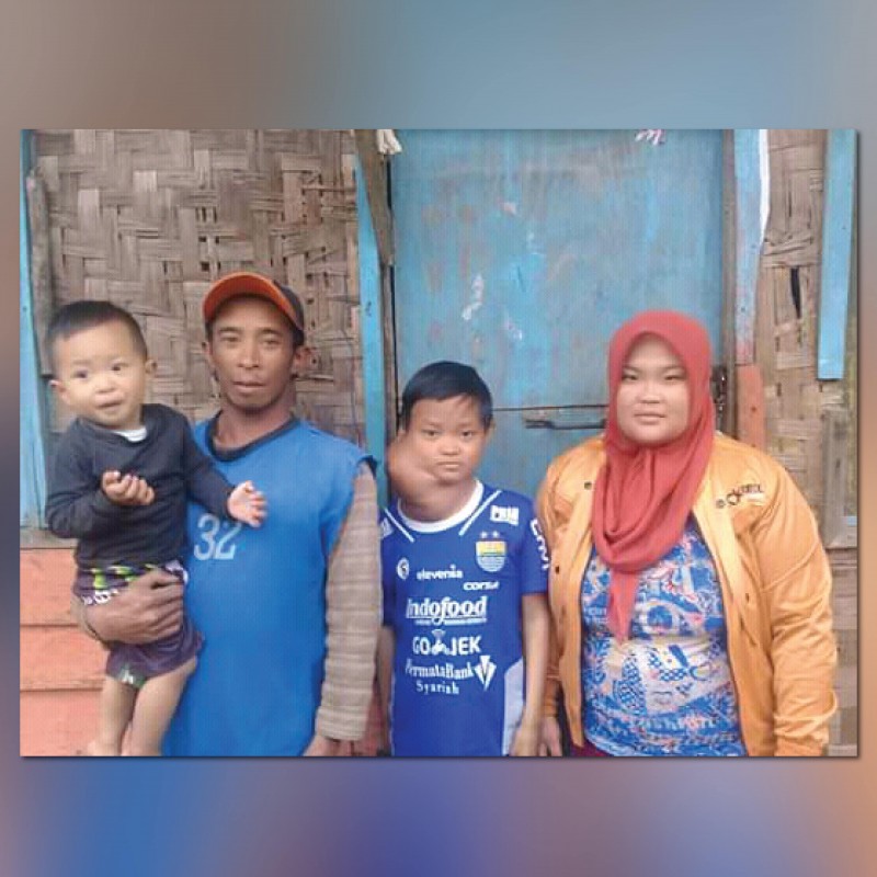 Tumor Sebesar Kepala Bersarang di Leher Deni, Ayo Bantu Ia Sembuh
