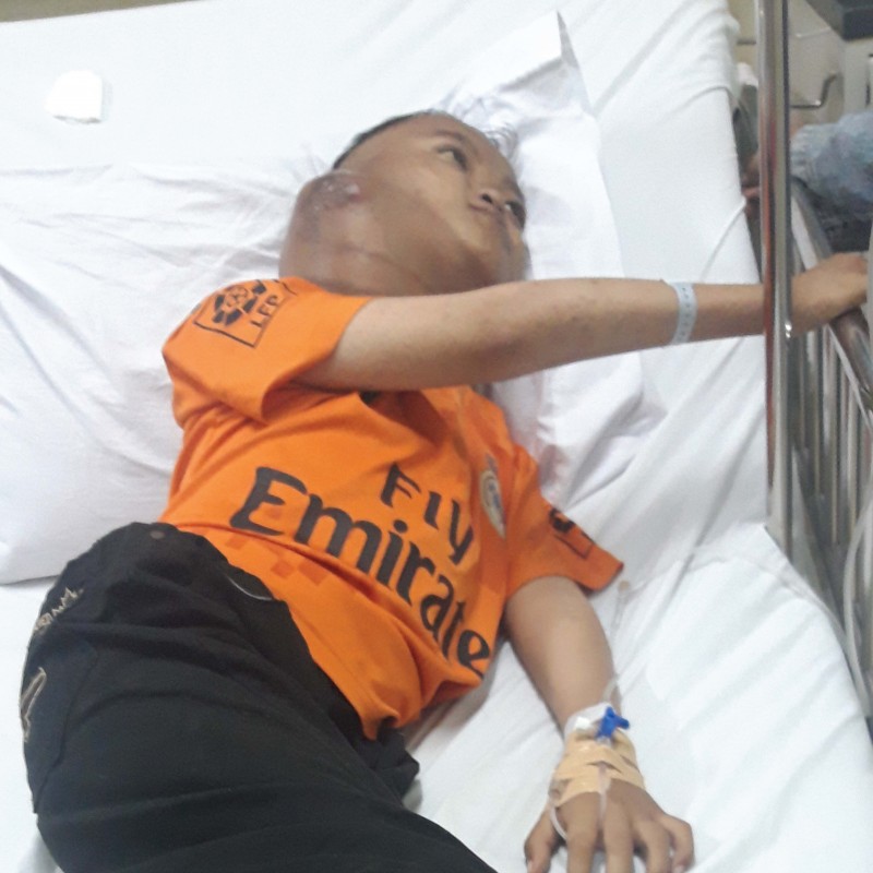 Tumor Sebesar Kepala Bersarang di Leher Deni, Ayo Bantu Ia Sembuh