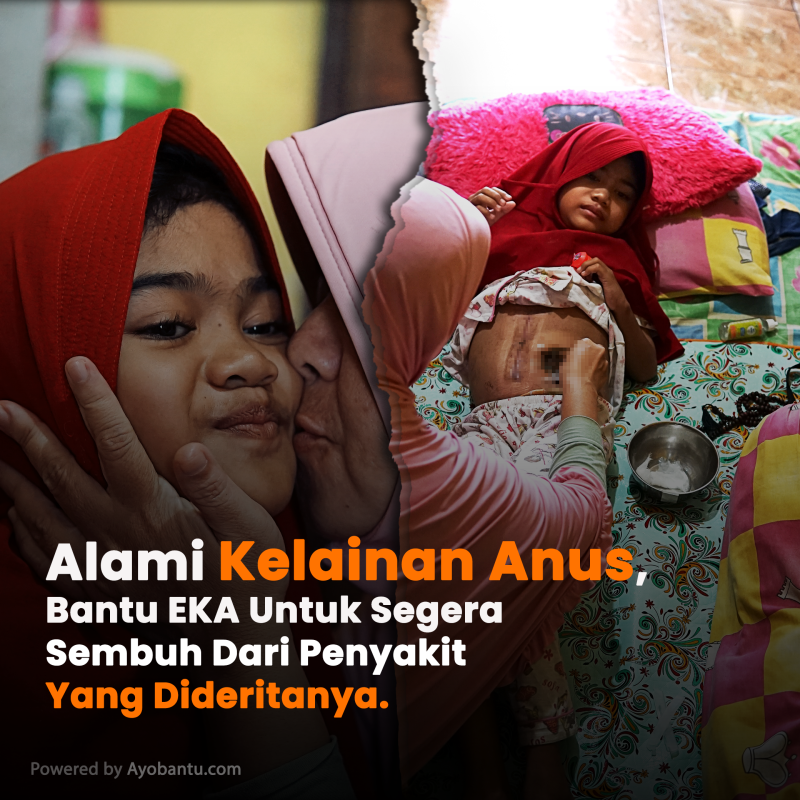 Ayo Bantu Eka Pengidap Kelainan Anus