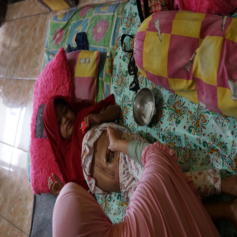 Ayo Bantu Eka Pengidap Kelainan Anus