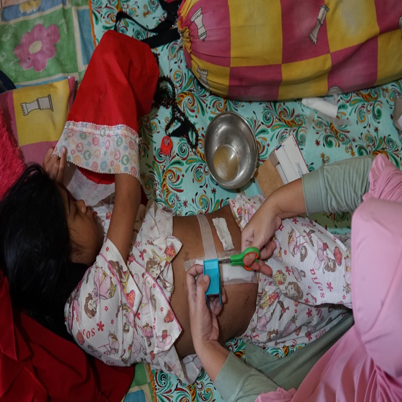 Ayo Bantu Eka Pengidap Kelainan Anus