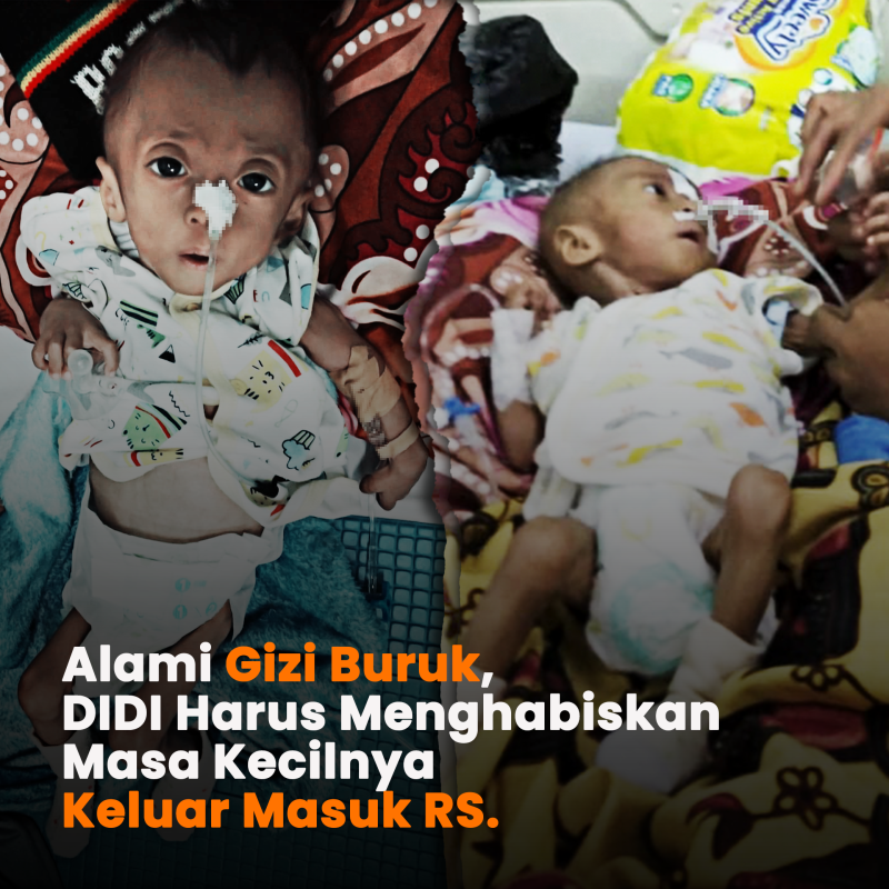 Alami Gizi buruk, Ayo Bantu DIDI sembuh