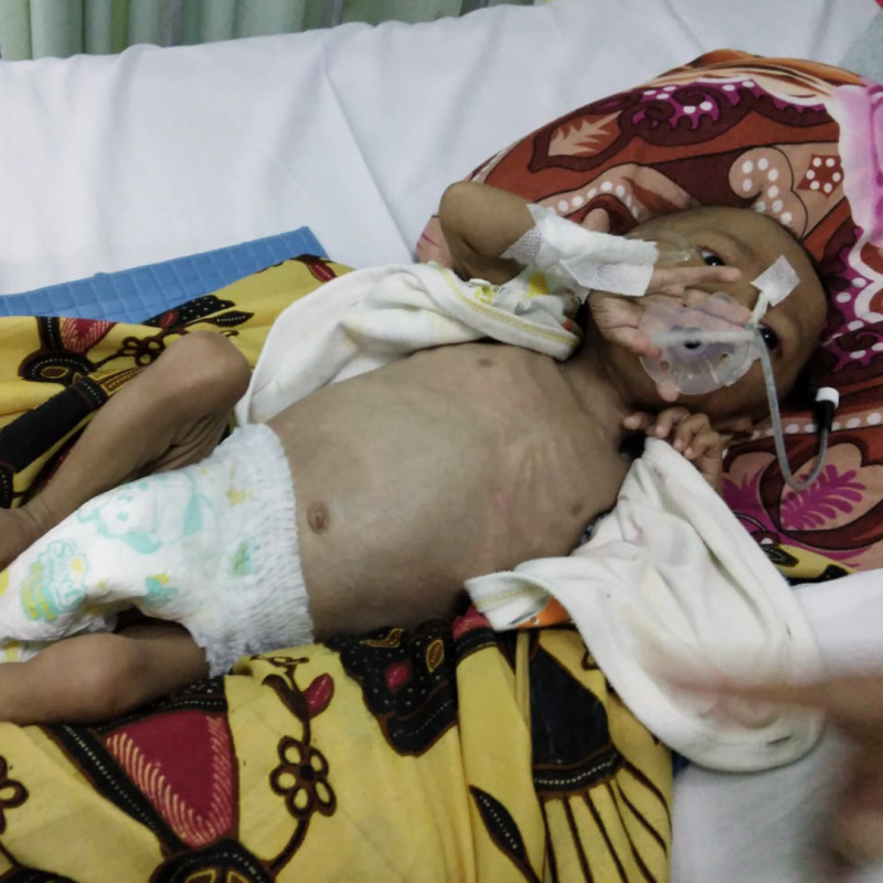 Alami Gizi buruk, Ayo Bantu DIDI sembuh