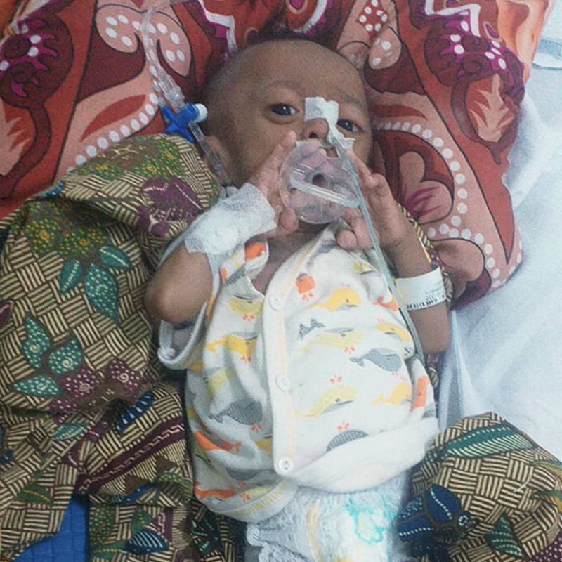 Alami Gizi buruk, Ayo Bantu DIDI sembuh