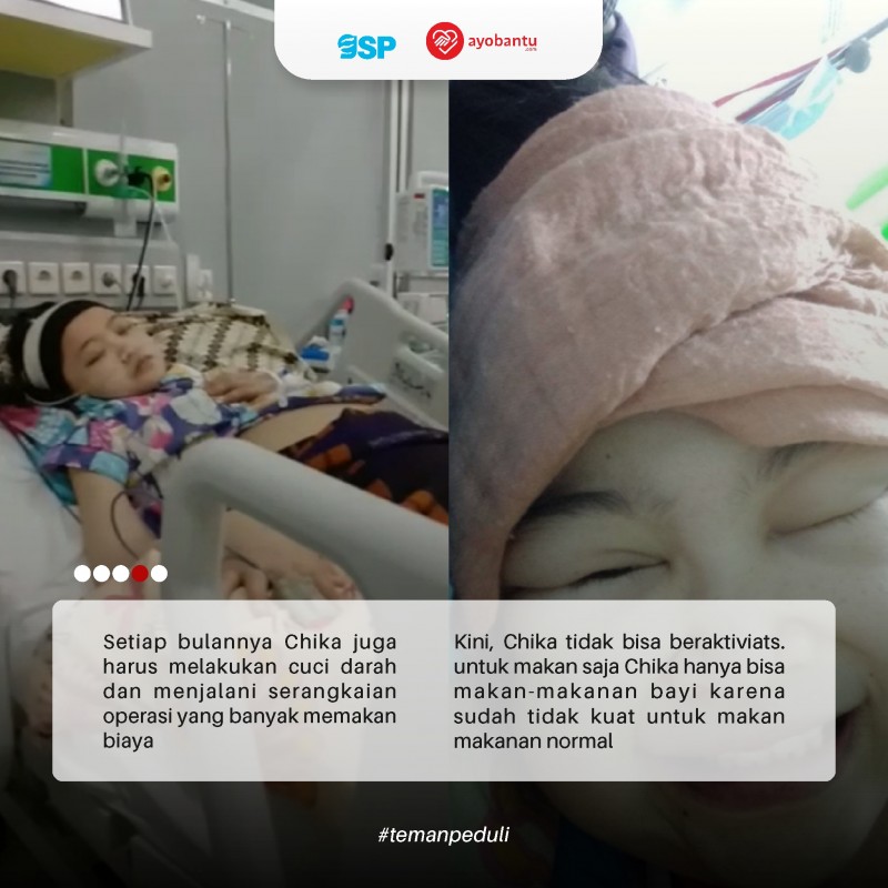 Chika, 2 Tahun Menderita Lupus dan Komplikasi di Tengah Keterbatasan Ekonomi