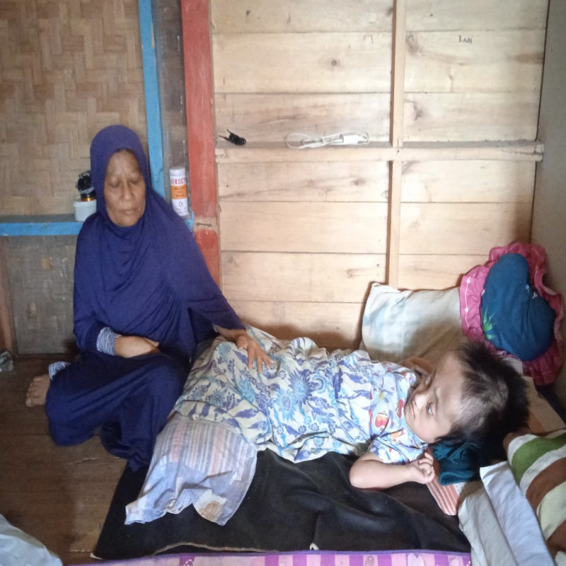 16 Tahun Mengidap Hydrosefalus, Rania Ingin Sembuh