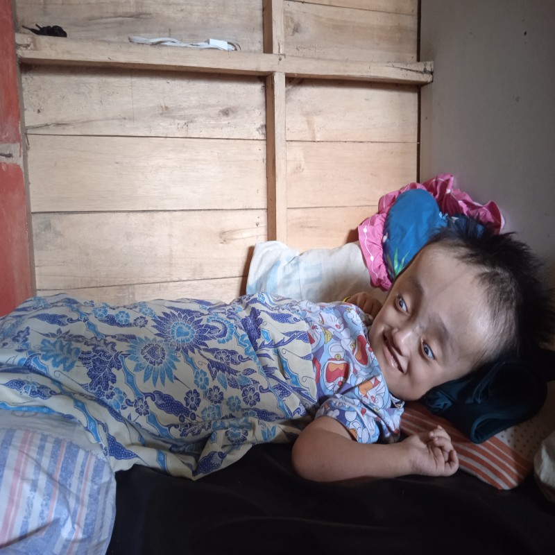 16 Tahun Mengidap Hydrosefalus, Rania Ingin Sembuh