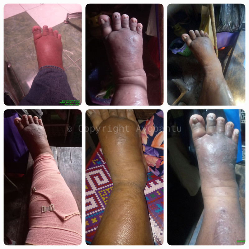 Bantu saya oprasi pengangkatan rahim dan sembuh dari 5penyakit lainnya