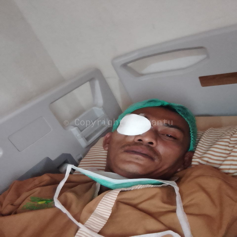 Bantu bapak Warjo melawan penyakit infeksi mata (glaucoma)