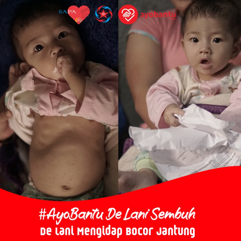 Ayo Bantu De Lani Sembuh, De Lani Mengidap Bocor Jantung
