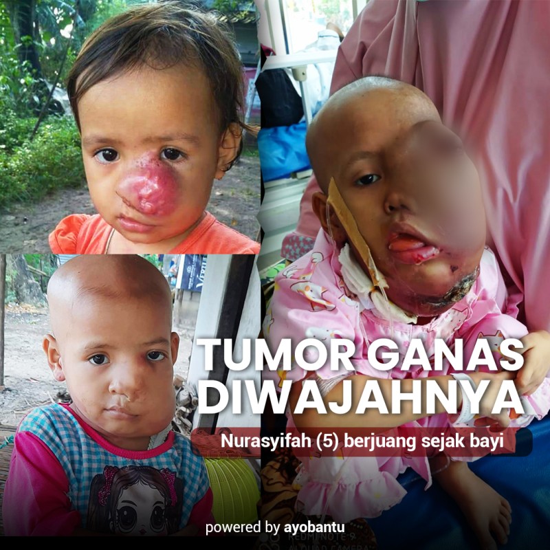 BANTU NUR ASYIFAH LAWAN TUMOR GANAS