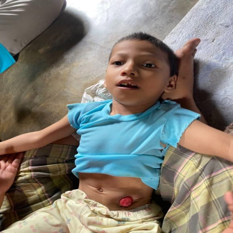 Tiap Hari Bergantung pada Kantong Kolostomi, Rozi Berharap Sembuh dan Sehat!