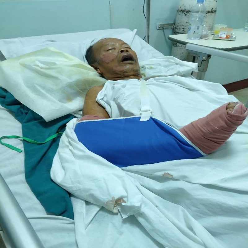 Ayo Bantu Pak Pee Sembuh, Penyandang Disabilitas yang Hidup Sebatang Kara