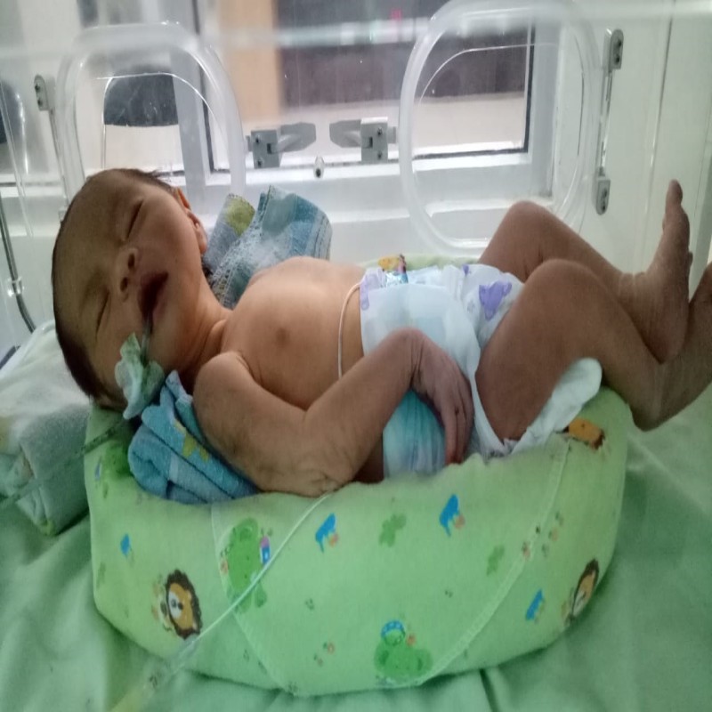 URGENT!! BAYI BARU LAHIR MENGELUARKAN KOTORAN LEWAT MULUT