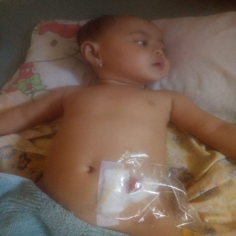 URGENT!! BAYI BARU LAHIR MENGELUARKAN KOTORAN LEWAT MULUT