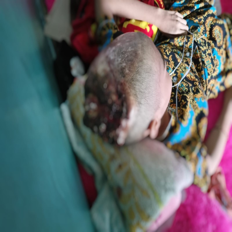 RAMBUT TERLILIT KIPAS KAPAL MEMBUAT KEPALA SHELA BERLUBANG
