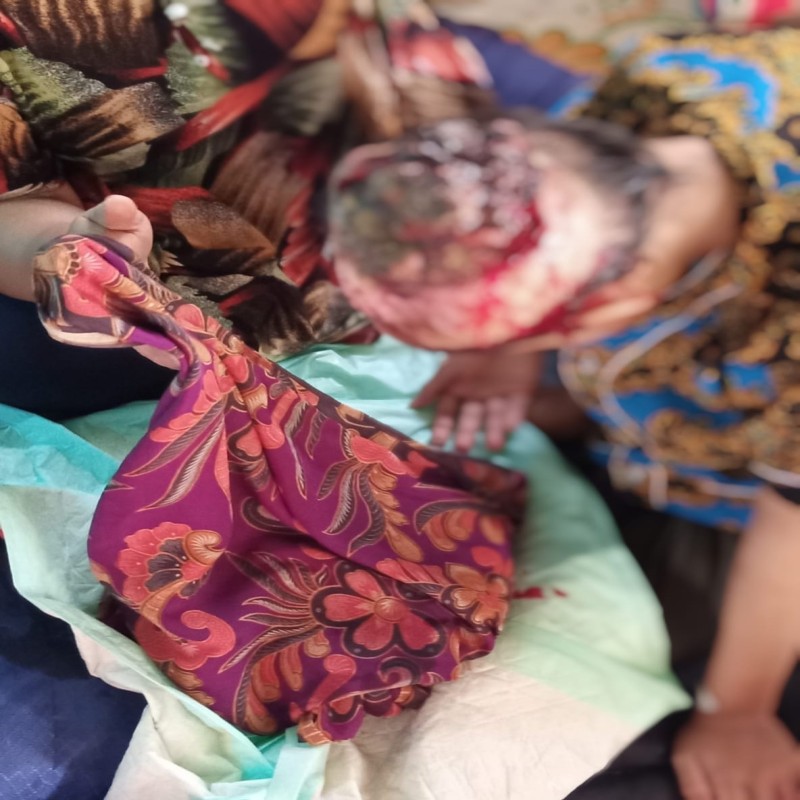 RAMBUT TERLILIT KIPAS KAPAL MEMBUAT KEPALA SHELA BERLUBANG