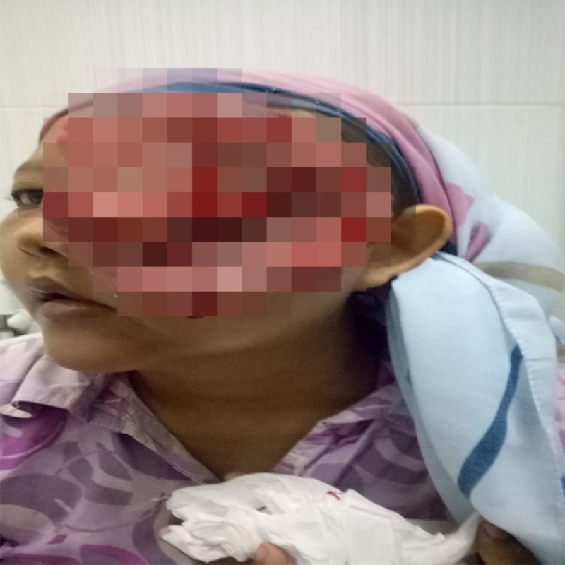 Berjuang Melawan Kanker Ganas yang Hendak Merenggut Hidupku