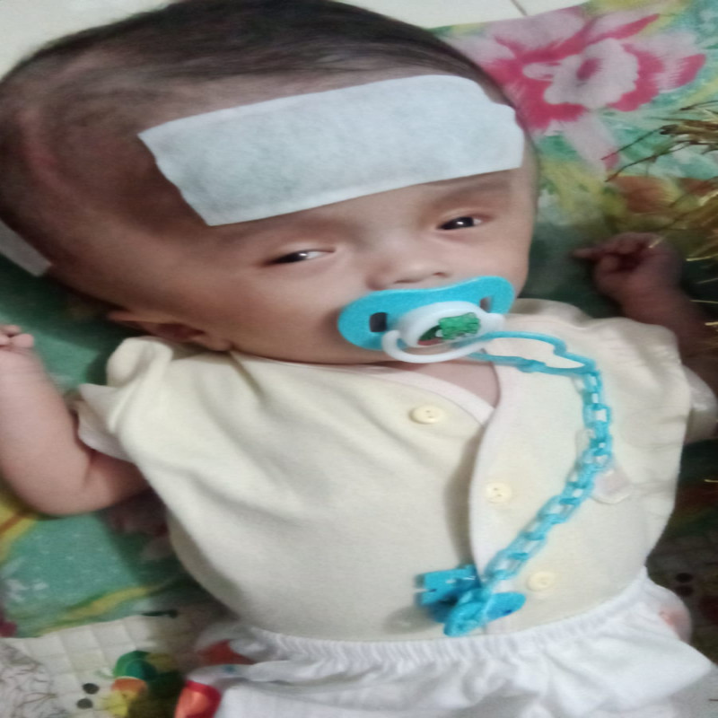 Ayo Selamatkan Bayi Defgan dari Hidrosefalus