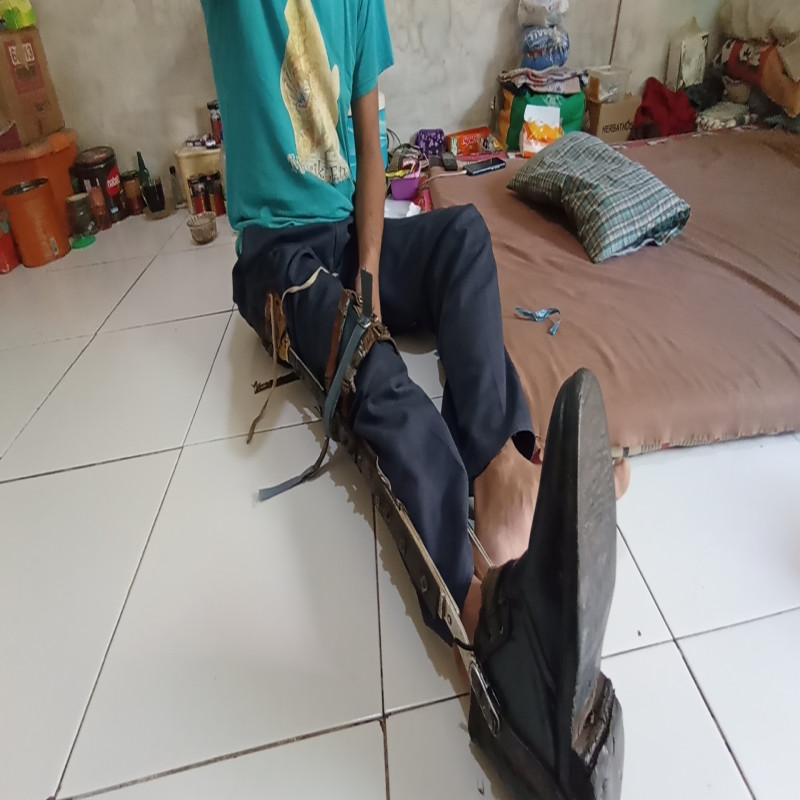 Bantu Kaki Palsu Harapan Pak Herman