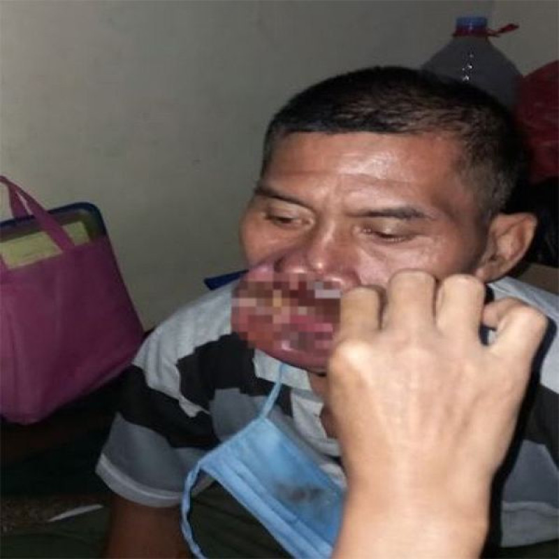 Kanker Pudarkan Senyuman Pak Enjat, Tolong! Bantu Guruku Segera Berobat.