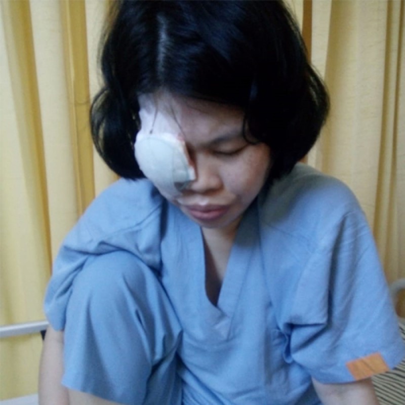 Alami Ablasi Retina, Bantu Kesembuhan Mata Ibu Okta