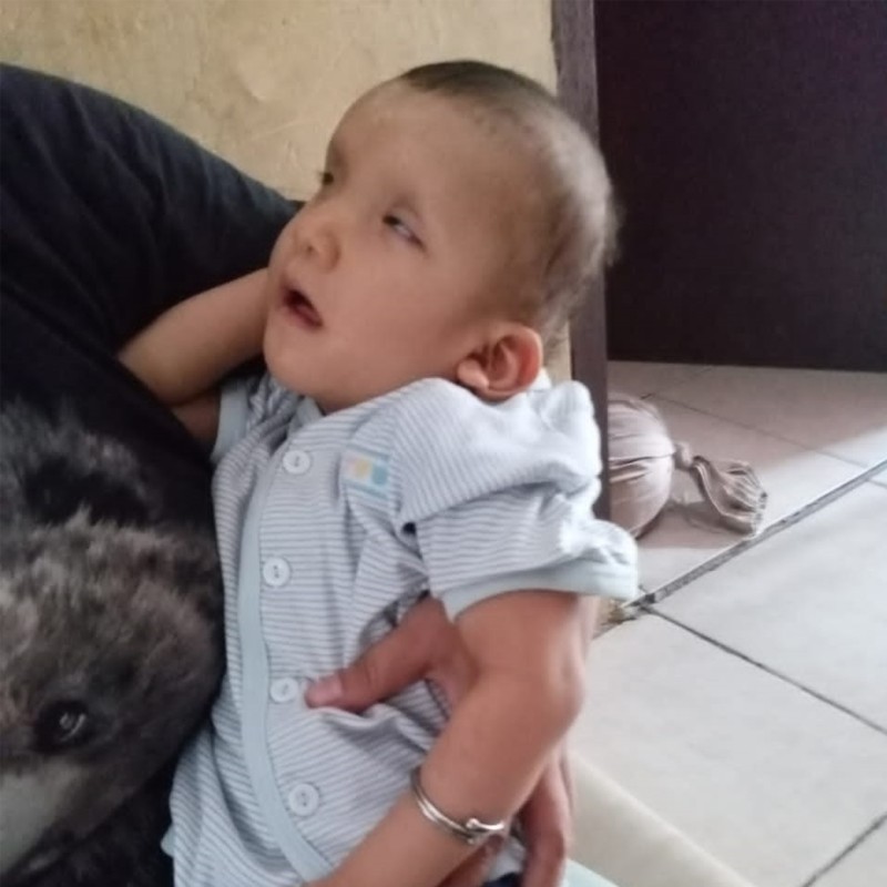 Derita Kelainan Jantung Sejak Bayi, Bantu Adik Grace Sembuh