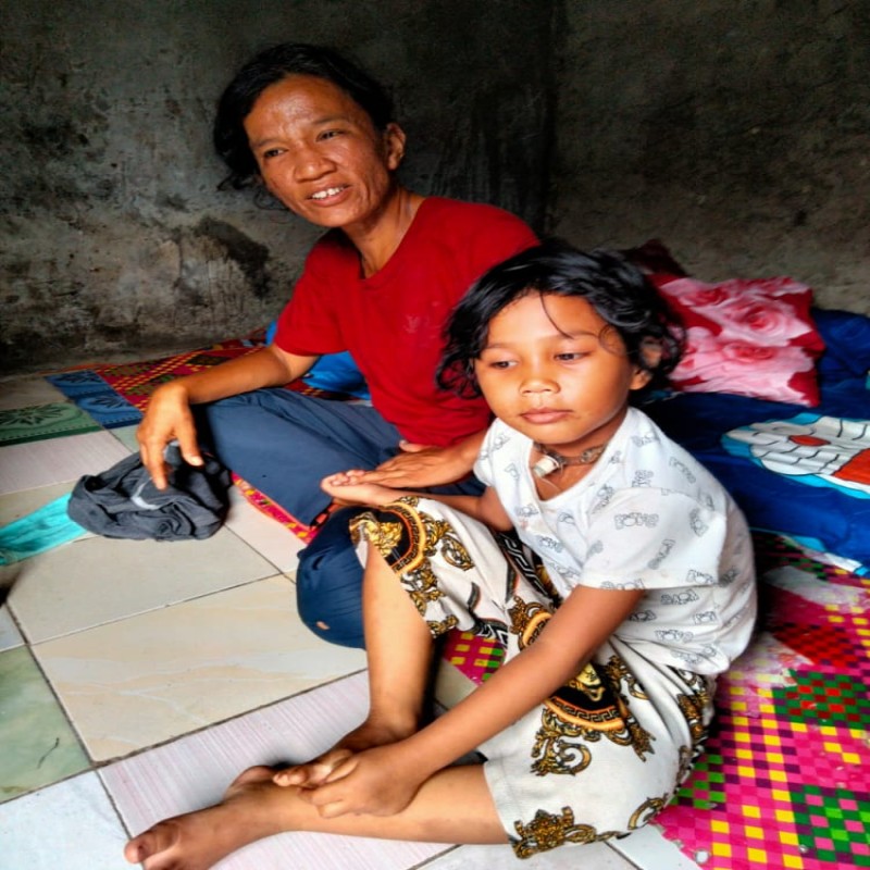 Harus Menggunakan Selang Untuk Bernafas, Bantu Lestiana Untuk Terus Bernafas!
