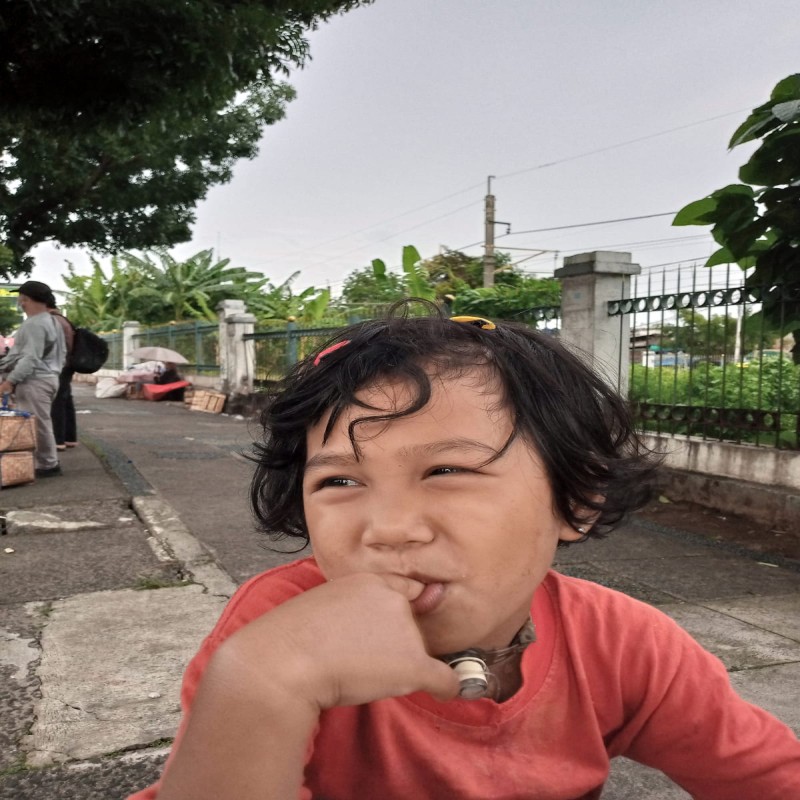 Harus Menggunakan Selang Untuk Bernafas, Bantu Lestiana Untuk Terus Bernafas!