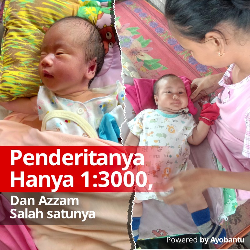Alami Penyakit Langka, Yuk Bantu Biaya Operasi Azzam agar Sembuh